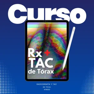 Curso de radiografía de tórax para principiantes